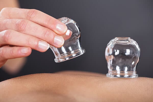 Cupping image